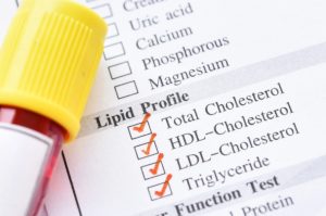 Jak obniżyć poziom złego cholesterolu?