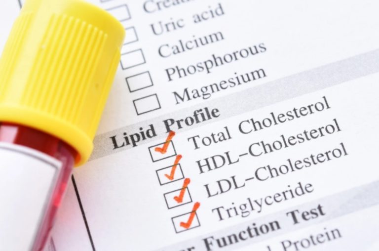 Jak obniżyć poziom złego cholesterolu?